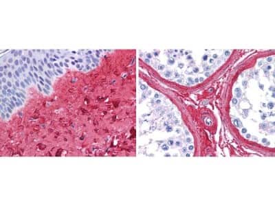 Immunohistochemistry: Collagen III alpha 1/COL3A1 Antibody [NB600-594]