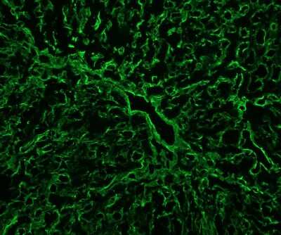 Immunohistochemistry-Frozen: Collagen IV Antibody [NB120-6586]