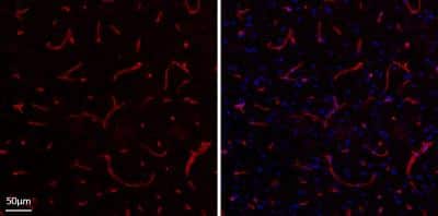 Immunohistochemistry-Frozen: Collagen IV Antibody [NBP1-26549]