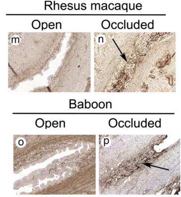 Immunohistochemistry: Collagen IV Antibody [NBP1-26549]
