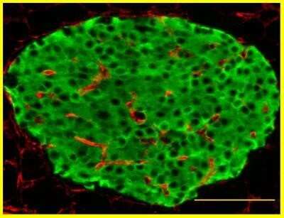 Immunohistochemistry-Paraffin: Collagen IV Antibody [NB120-6586]