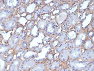 Immunohistochemistry-Paraffin: Collagen IV Antibody (M3F7) [NBP3-07597]