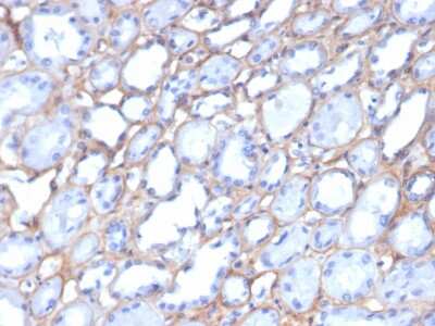 Immunohistochemistry-Paraffin: Collagen IV Antibody (M3F7) [NBP3-07597]