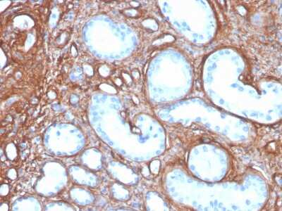 Immunohistochemistry-Paraffin: Collagen IV Antibody (rCOL4/4742) - Azide and BSA Free [NBP3-08487]