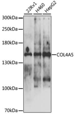 Western Blot: Collagen IV alpha5 AntibodyBSA Free [NBP2-92585]