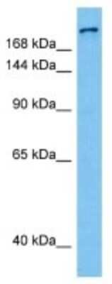 Western Blot: Collagen IV alpha5 Antibody [NBP3-10862]