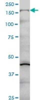 Western Blot: Collagen V Antibody (2F4) [H00001289-M01]