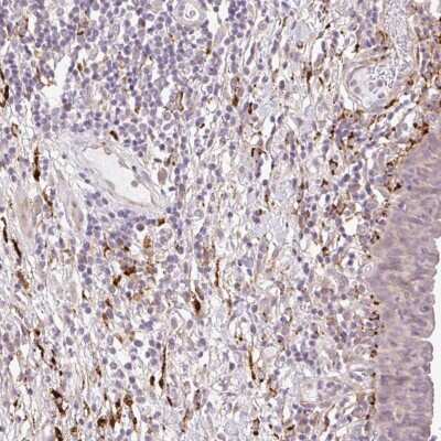 Immunohistochemistry-Paraffin: Collagen V Antibody [NBP2-38162]