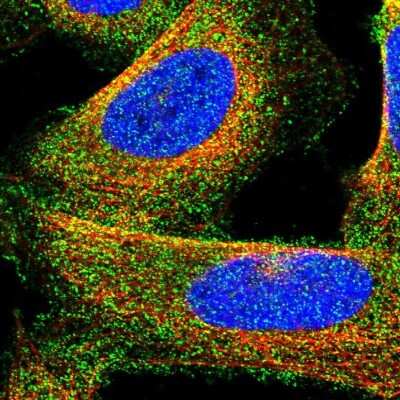 Immunocytochemistry/ Immunofluorescence: Collagen VI alpha 1 Antibody [NBP1-91195]