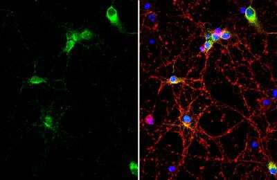 Immunocytochemistry/ Immunofluorescence: Collagen VI alpha 1 Antibody [NBP2-15947]