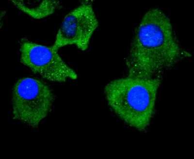 Immunocytochemistry/ Immunofluorescence: Collagen VI alpha 1 Antibody (SD83-03) [NBP2-67825]