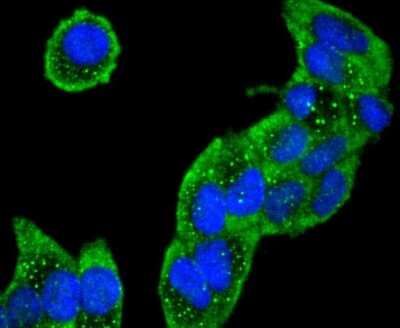Immunocytochemistry/ Immunofluorescence: Collagen VI alpha 1 Antibody (SD83-03) [NBP2-67825]