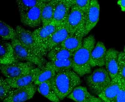 Immunocytochemistry/ Immunofluorescence: Collagen VI alpha 1 Antibody (SD83-03) [NBP2-67825]