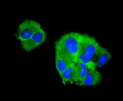 Immunocytochemistry/ Immunofluorescence: Collagen VI alpha 1 Antibody (SD83-03) [NBP2-67825]