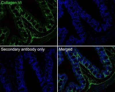 Immunohistochemistry-Paraffin: Collagen VI alpha 1 Antibody (SD83-03) [NBP2-67825]