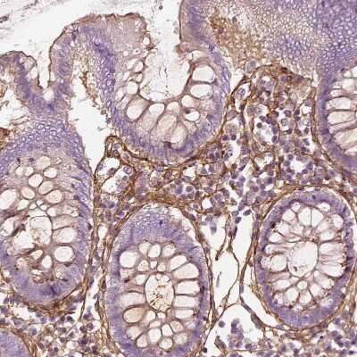 Immunohistochemistry-Paraffin: Collagen VI alpha 2 Antibody [NBP2-55655]