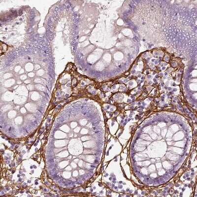 Immunohistochemistry-Paraffin: Collagen VI alpha 2 Antibody [NBP2-58879]