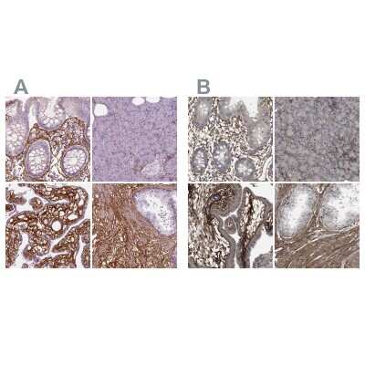 Immunohistochemistry-Paraffin: Collagen VI alpha 2 Antibody [NBP2-58879]