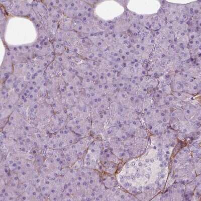 Immunohistochemistry-Paraffin: Collagen VI alpha 2 Antibody [NBP2-58879]