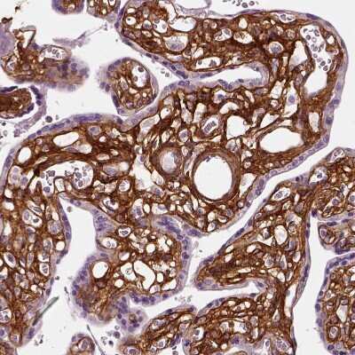 Immunohistochemistry-Paraffin: Collagen VI alpha 2 Antibody [NBP2-58879]