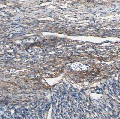 Immunohistochemistry-Paraffin: Collagen VI alpha 3 Antibody [NBP2-34837]