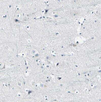 Immunohistochemistry-Paraffin: Collagen VI alpha 3 Antibody [NBP2-34837]
