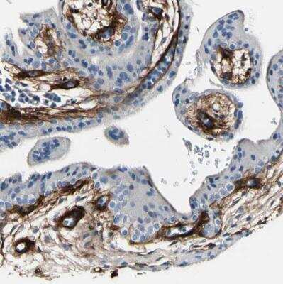 Immunohistochemistry-Paraffin: Collagen VI alpha 3 Antibody [NBP2-34837]