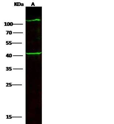 Western Blot: Collagen VI alpha 3 Antibody [NBP2-97126]