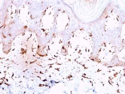 Immunohistochemistry-Paraffin: Collagen VII Antibody (LH7.2) [NBP3-07751]