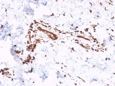 Immunohistochemistry-Paraffin: Collagen VII Antibody (LH7.2) [NBP3-07751]