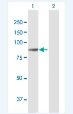Western Blot: Collagen VIII alpha 1 Antibody [H00001295-B01P-50ug]