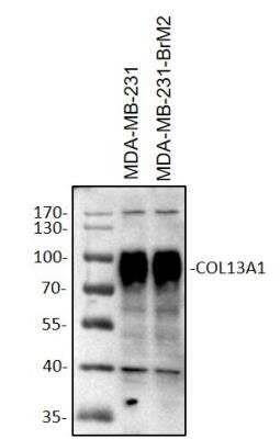 Western Blot: Collagen XIII alpha 1 Antibody [NBP2-13854]