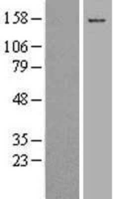 Western Blot: Collagen XVII Overexpression Lysate [NBL1-09350]