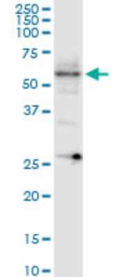 Western Blot: Collybistin/ARHGEF9 Antibody (3C11) [H00023229-M01]