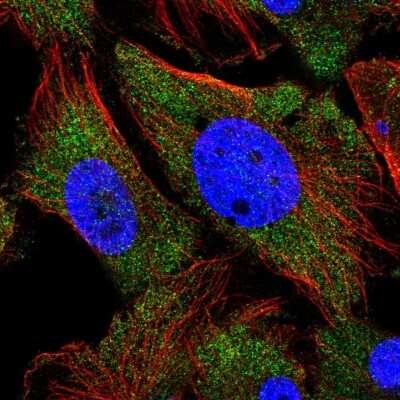 Immunocytochemistry/ Immunofluorescence: Collybistin/ARHGEF9 Antibody [NBP2-58566]
