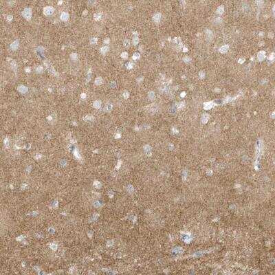 Immunohistochemistry-Paraffin: Collybistin/ARHGEF9 Antibody [NBP1-81509]