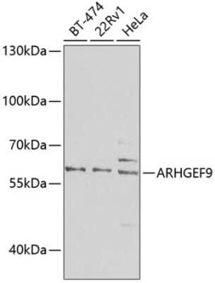 Western Blot: Collybistin/ARHGEF9 AntibodyBSA Free [NBP2-92919]