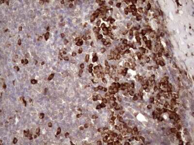 Immunohistochemistry: Common beta Chain Antibody (OTI4H3) [NBP2-46365]