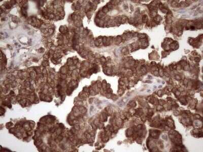 Immunohistochemistry: Common beta Chain Antibody (OTI4H3) - Azide and BSA Free [NBP2-70463]