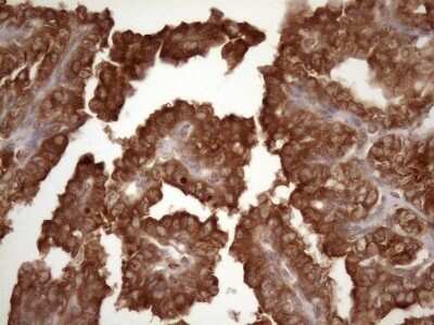 Immunohistochemistry: Common beta Chain Antibody (OTI4H3) - Azide and BSA Free [NBP2-70463]