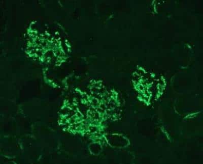 Immunocytochemistry/ Immunofluorescence: Complement C3 Antibody (11H9) - BSA Free [NB200-540]