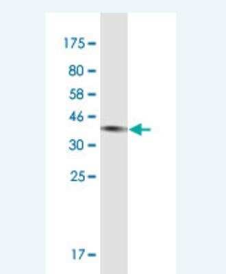 Western Blot: Complement C3 Antibody (X1) [H00000718-M11-100ug]