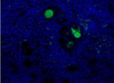 Immunohistochemistry: Complement C3a Antibody (K13/16-5.7) - BSA Free [NBP1-05122]