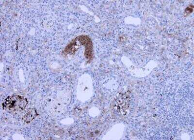 Immunohistochemistry-Paraffin: Complement C3a Antibody (K13/16-5.7) - BSA Free [NBP1-05122]