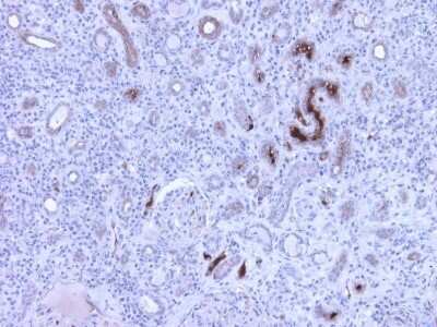 Immunohistochemistry: Complement C4c Antibody (99-72-18) - BSA Free [NBP3-12091]