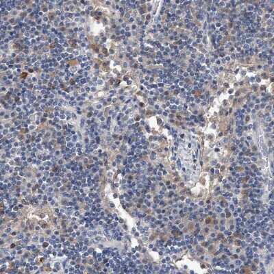 Immunohistochemistry-Paraffin: Complement C5 Antibody [NBP1-84395]