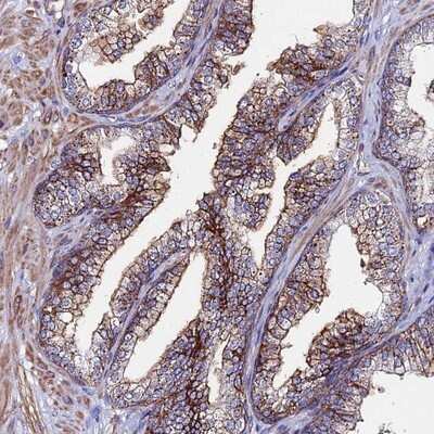 Immunohistochemistry-Paraffin: Complement C6 Antibody [NBP1-91803]