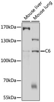 Western Blot: Complement C6 AntibodyBSA Free [NBP3-03587]