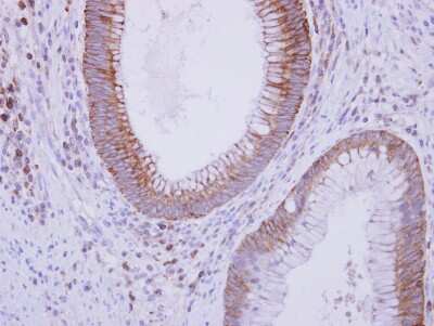 Immunohistochemistry-Paraffin: Complement Component C9 Antibody [NBP2-15951]