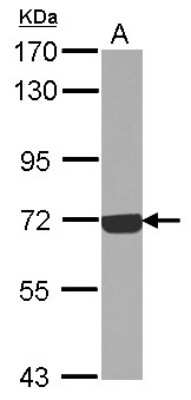 Western Blot: Complement Component C9 Antibody [NBP2-15951]
